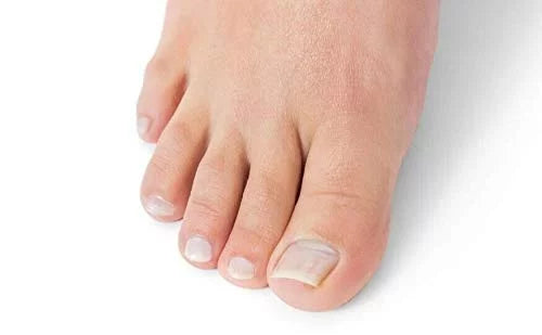 Oriundo Life Nail Treatment, Tratamiento Para Uñas, Extra Strength Nail Renewal, Made in USA